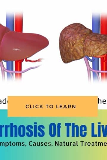 Cirrhosis Of The Liver